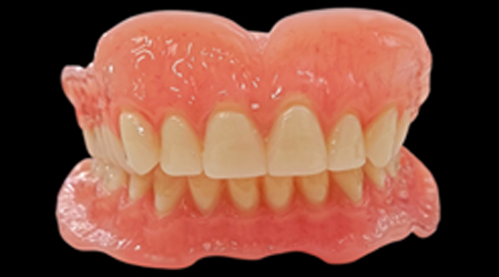 Removable Prosthesis-vinayaga dental lab